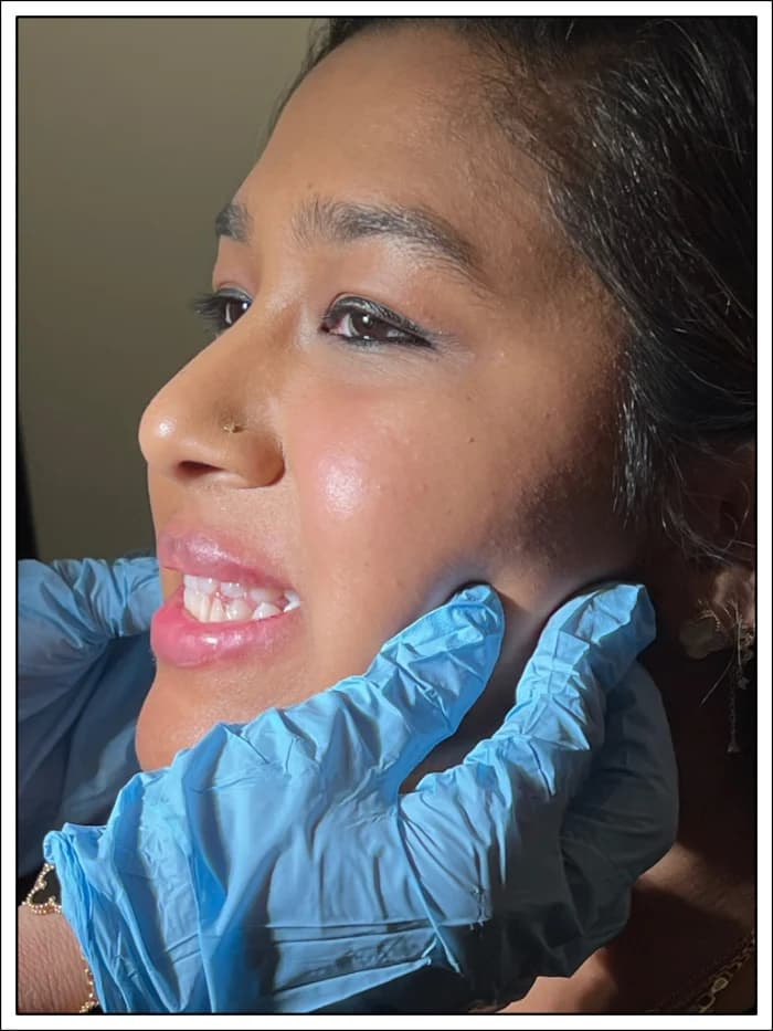 Dr Caridi palpating a patient's masseter muscle before botox treatment